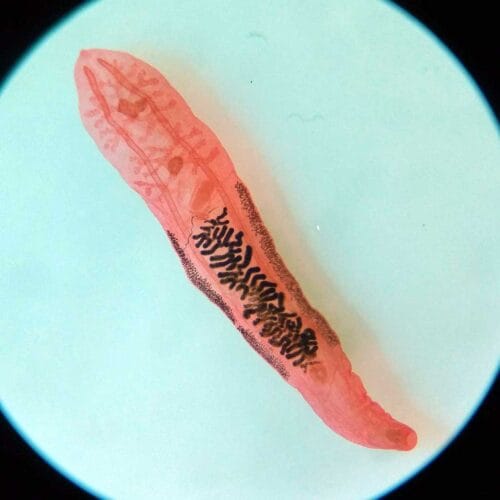 Clonorchis sinensis whole mount