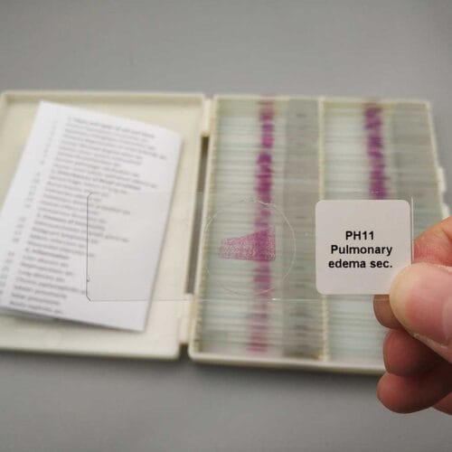 human pathology slides 100pcs