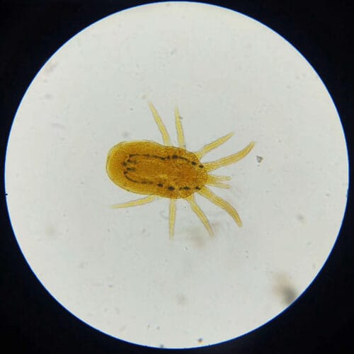 Mite-w.m.-under-microscope