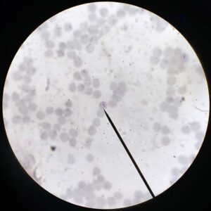 Plasmodium falciparum with gametohyte smear prepared microscope slides