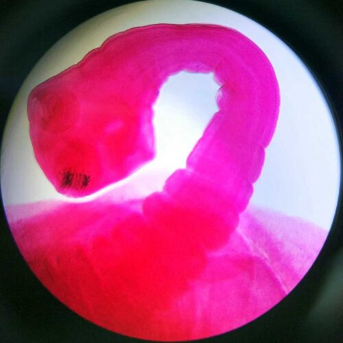 Taenia Solium scolex w.m. prepared microscope slides.