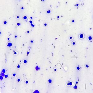 Toxoplasma gondii trophozoite smear