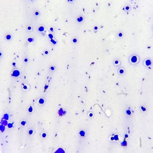 Toxoplasma gondii trophozoite smear