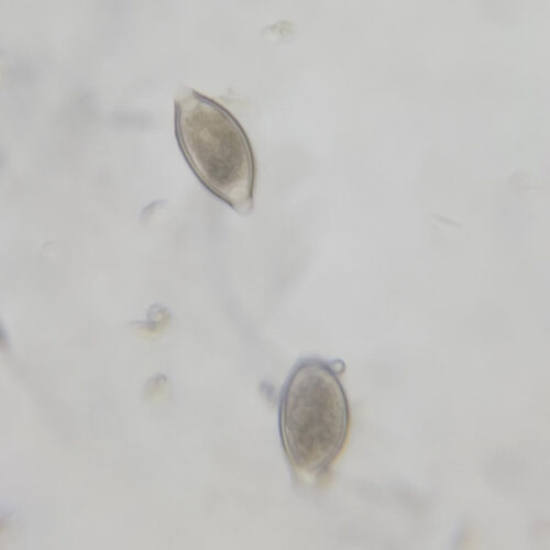 Trichuris trichiura ova