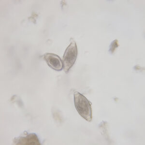 Trichuris trichiura ova whole mount