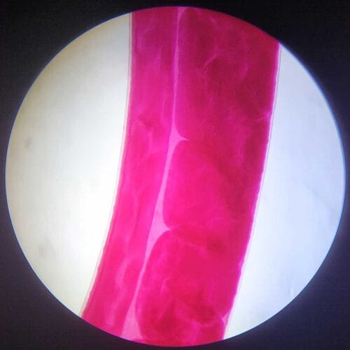 male-Trichuris-trichiura-adult