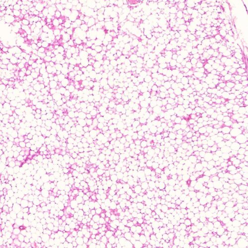 Human Adipose tissue sec., 7 µm sec.