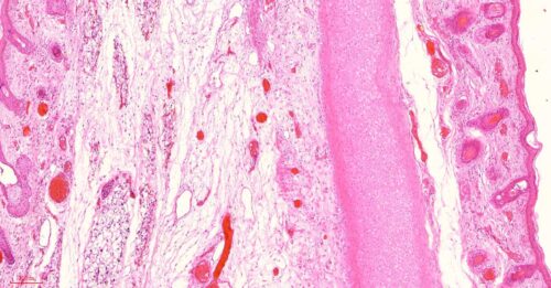 Human Elastic cartilage section, or say yellow cartilage prepared slides, 7 µm sec., H.E. Stain, wholesale