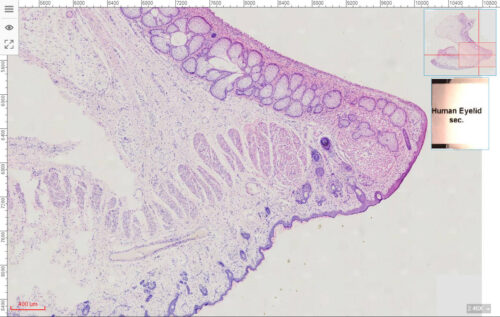 Human eyelid section prepared slides, 7 µm sec., H&E Stain, wholesale - Image 2