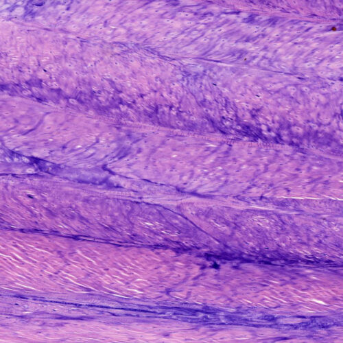 Human Fibrocartilage intervertebral disc section