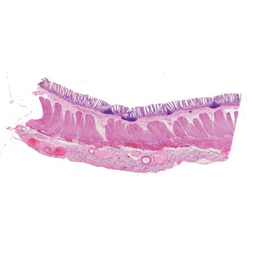 Human colon section