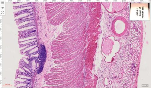 Human colon section 5X