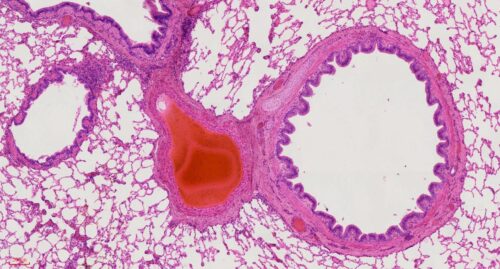 Human lung section histology slides, 7 µm sec., H&E Stain