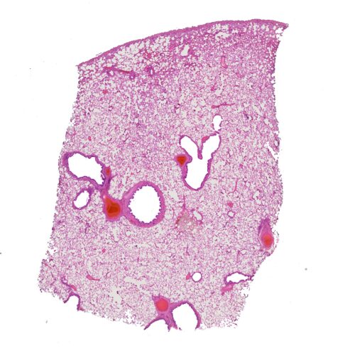 Human lung section histology slides, 7 µm sec., H&E Stain, human histology slides wholesale supplier