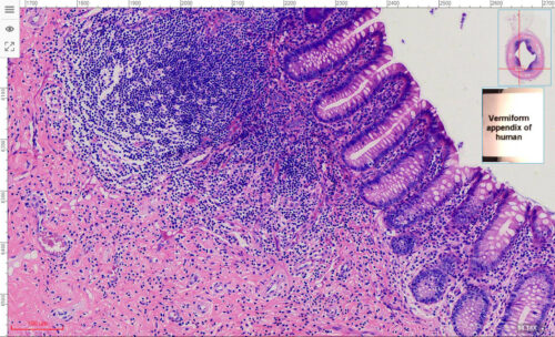 Vermiform appendix human