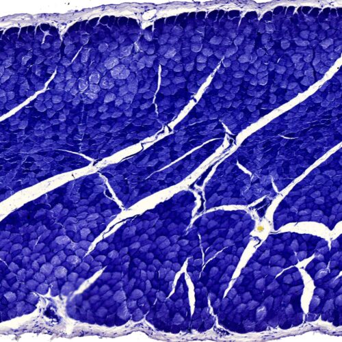 Skeletal muscle of Human t.s. (Hematoxylin Stain)