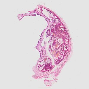 human prostate gland section prepared slides