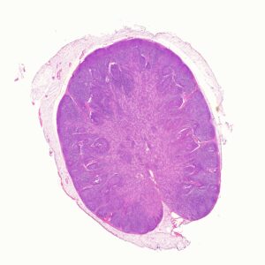 human lymph node section histology slides