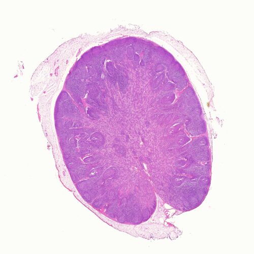 human lymph node section histology slides