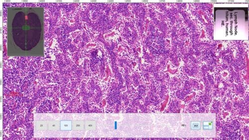 1pcs human lymph node section through hilum, H.E. stain - Image 4