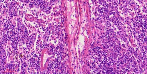 1pcs human lymph node section through hilum, H.E. stain - Image 2