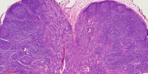 1pcs human lymph node section through hilum, H.E. stain - Image 3