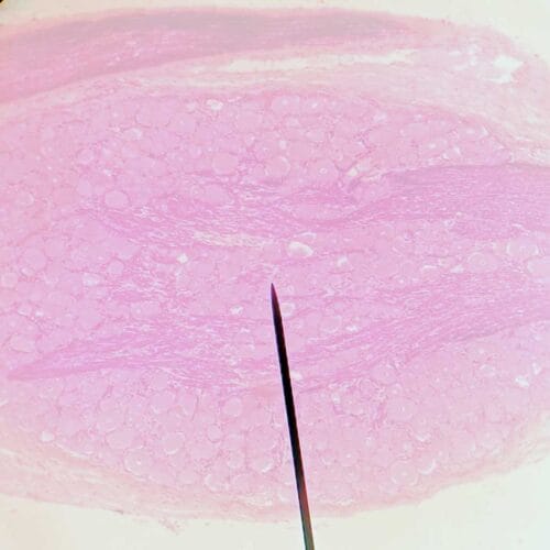 spinal ganglion or dorsal root ganglion section, H&E Stain - Image 2