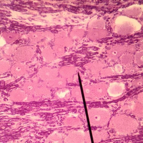 spinal ganglion or dorsal root ganglion section, H&E Stain - Image 3