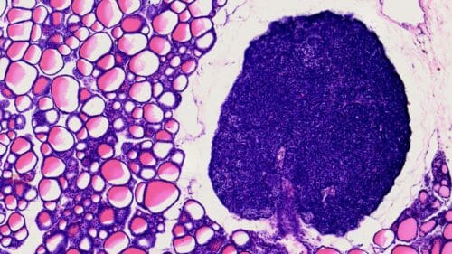 1pcs thyroid and parathyroid section prepared microscope slides, H.E. stain - Image 2