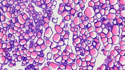 1pcs thyroid and parathyroid section prepared microscope slides, H.E. stain - Image 4