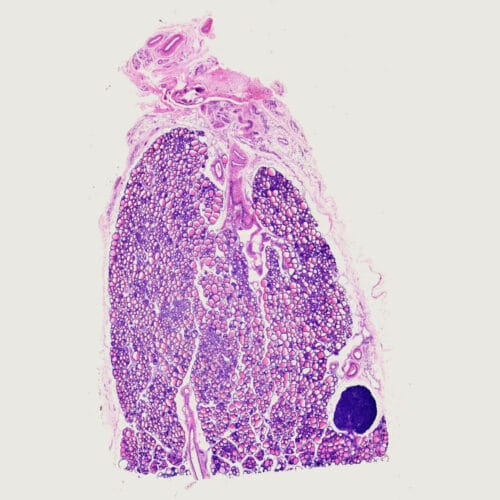 thyroid and parathyroid