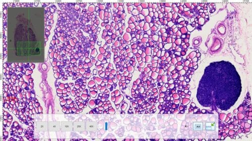 1pcs thyroid and parathyroid section prepared microscope slides, H.E. stain - Image 3