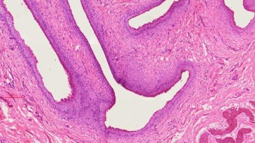 1pcs human bladder section, H.E. stain - Image 2