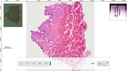 1pcs human bladder section, H.E. stain - Image 3