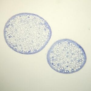 ascaris equorum uterus section show animal mitosis all stages