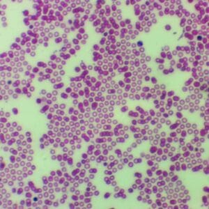 human blood smear, H.E. Stain