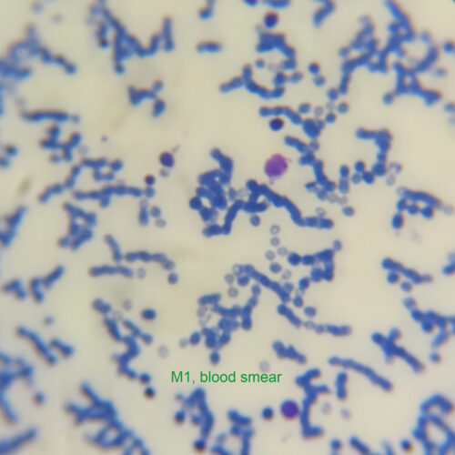 M1, Blood smear