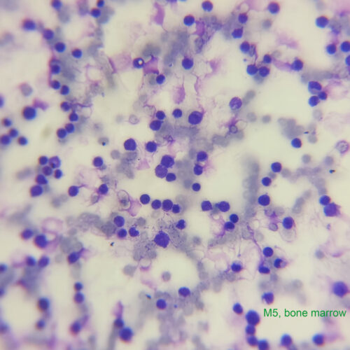 M5 bone marrow