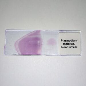 Plasmodium malariae