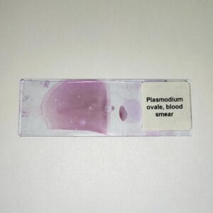 Plasmodium ovale blood smear