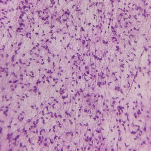 mast cells prepared slides