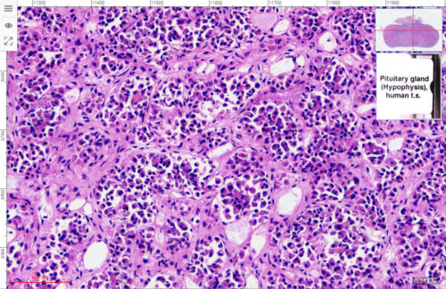 Pituitary gland human 18X