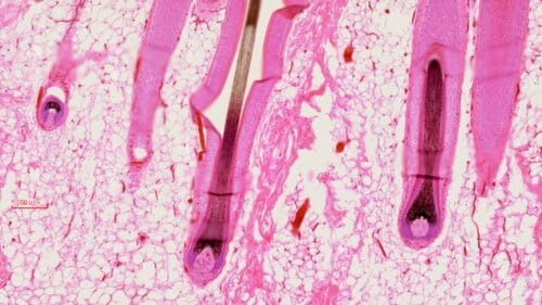 human scalp L.S., H.E. stained, showing hair follicles, sebaceous and sweat glands