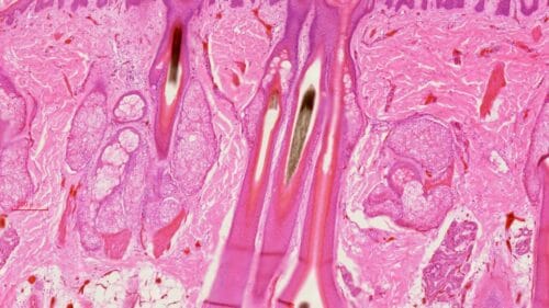 human scalp L.S., H.E. stained, showing hair follicles, sebaceous and sweat glands