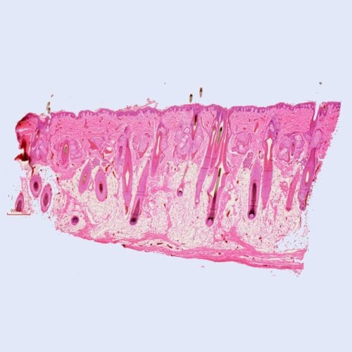 human scalp L.S., H.E. stained, showing hair follicles, sebaceous and sweat glands