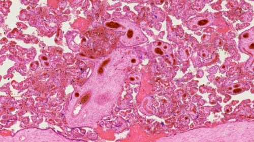 Affordable 1pcs Human Placenta, c.s. through uterine wall, H.E. Stained, wholesale supplier - Image 2