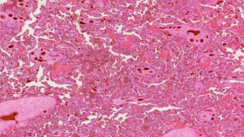 Affordable 1pcs Human Placenta, c.s. through uterine wall, H.E. Stained, wholesale supplier - Image 3