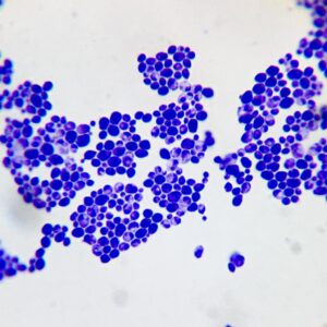 Candida albicans smear