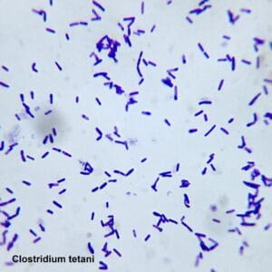 Clostridium tetani