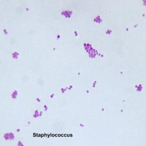 Staphylococcus smear